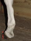 high bow tendon