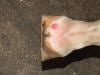 Coronet forging injury treatment
