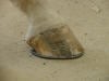 collapsed heel corrected