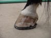 collapsed heel corrected