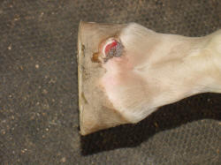 forging injury