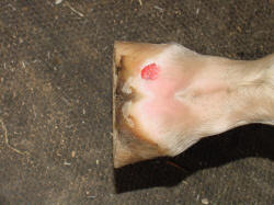 forging injury